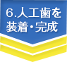 6.人工歯を装着・完成